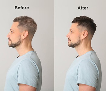 Hår vender tilbage og selvtillid fordobles