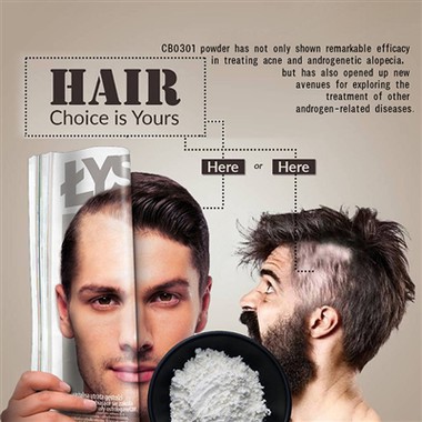 Hvorfor får jeg akne i min hovedbund? Eksperter forklarer akne og skæl i hove...