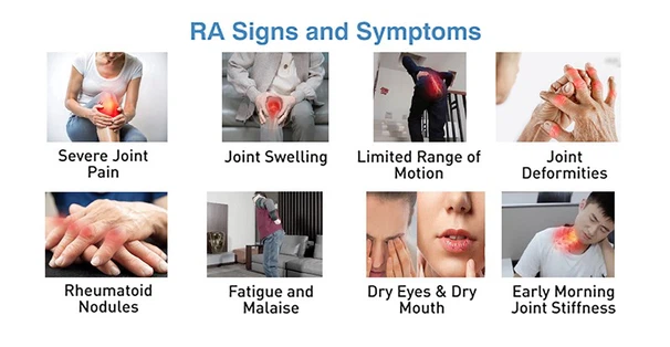 37Auranofin powder Ajpg 37Auranofin powder Ajpg